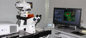 激光共聚焦显微镜的原理与普通显微镜有哪些不同？