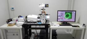 激光共聚焦显微镜的优点和工作原理是什么